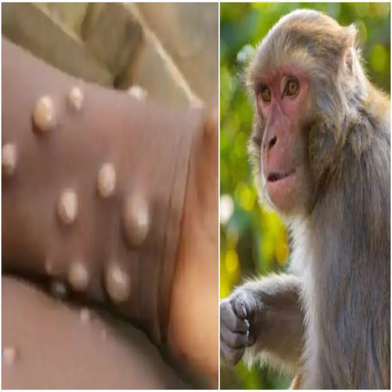 report-on-the-possible-danger-of-monkey-flu-to-sri-lanka