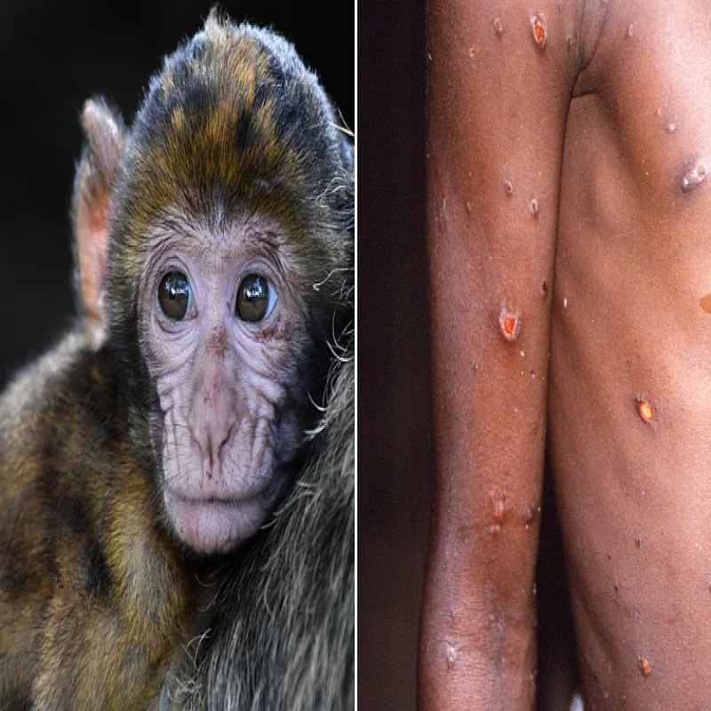 monkey-measles-currently-spreading-in-lebanon
