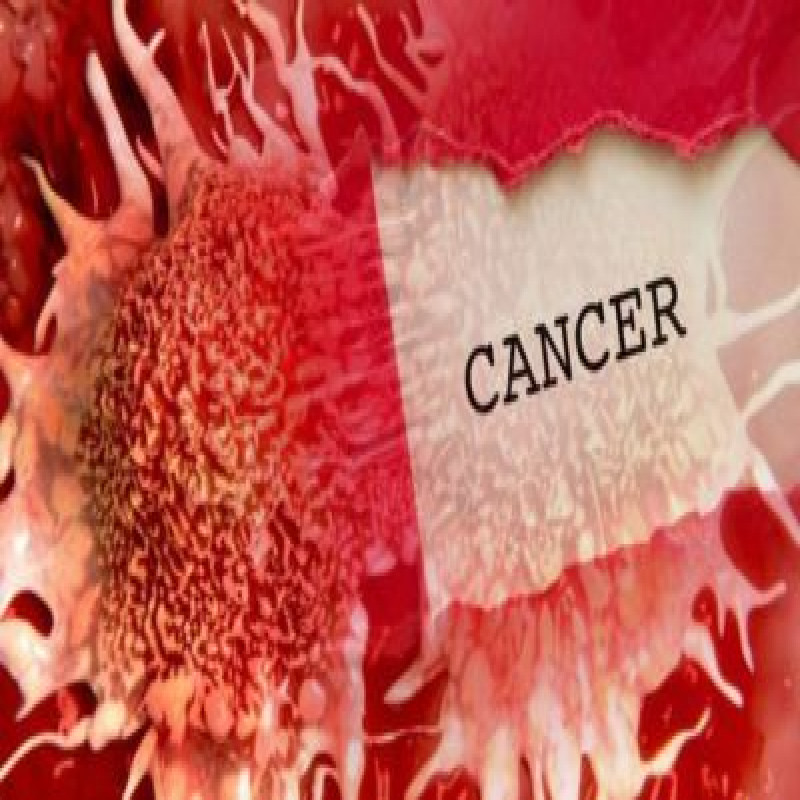 oral-cancer-on-the-rise-in-sri-lanka:-shocking-information-released