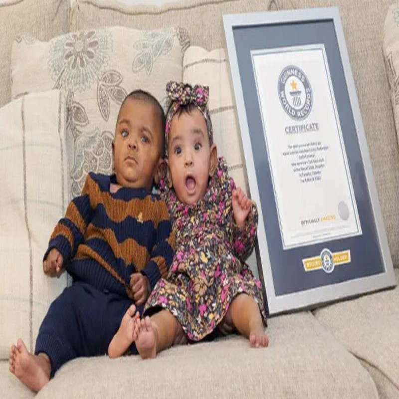 guinness-world-record-winning-twins-at-birth!