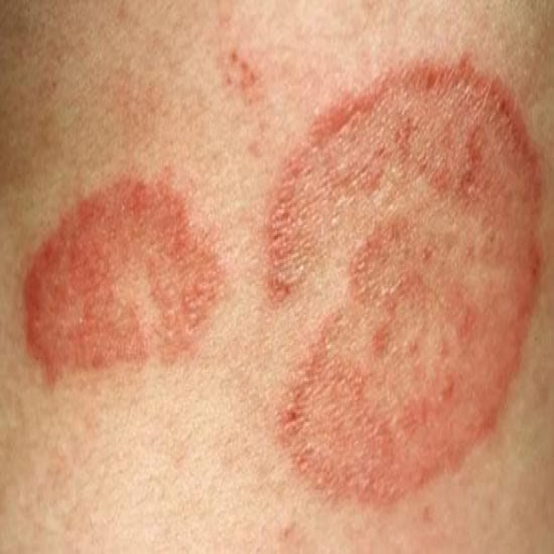 deadly-bacteria-spreading-rapidly-in-japan:-demand-that-the-sri-lankan-government-should-take-the-right-decision