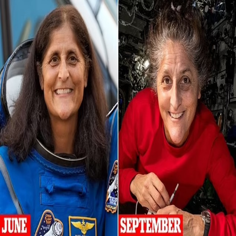 sunitha-williams's-facial-change-that-caused-controversy!-doctors-explain