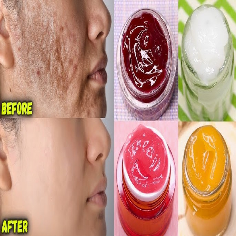 warning-given-to-pregnant-mothers-using-creams-in-sri-lanka